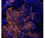 Checkpoint Blockade Therapies: Ushering in the Second Wave