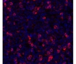 Utilizing TIGIT in the Targeting of T and NK Cells