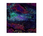 Albumin: A Marker of Tissue Damage and Organ Function