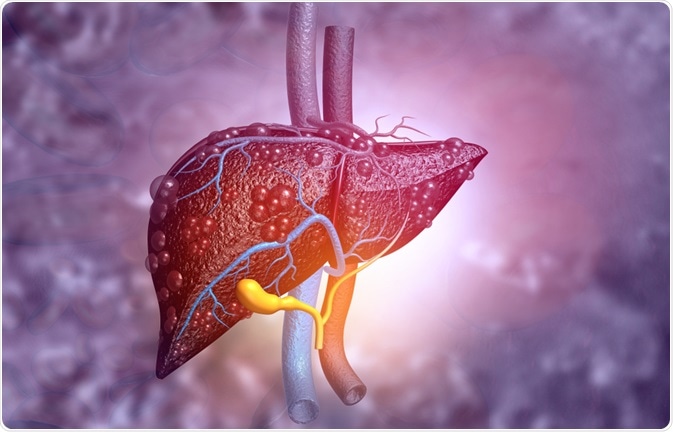 liver disease