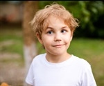 Strabismus Symptoms
