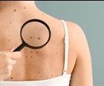 Mole Mapping