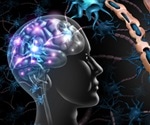 Relapsing-Remitting Multiple Sclerosis (RRMS)