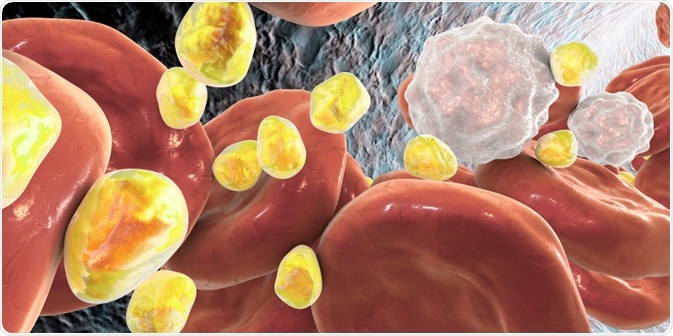 triglycerides