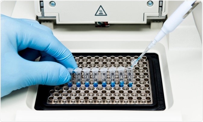 PCR