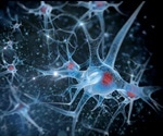What is Neuropsychiatric Lupus (NPSLE)?
