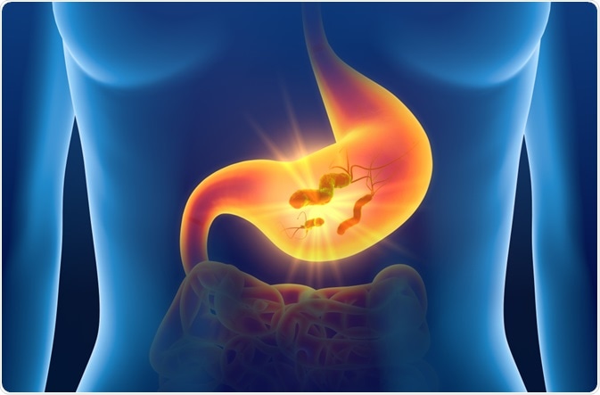 gastritis