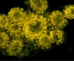 Male fertility and androgen production may be impacted by COVID-19