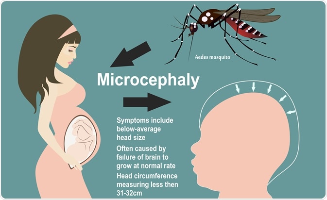 zika virus