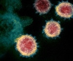 "COVID-19 diarrhea" depends on inflammatory response that is part of the disease