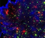 Researchers examine if a naturally occurring protein can be used to prevent sight loss from glaucoma