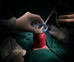 Gastroschisis Prognosis