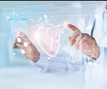 What is Telecardiology?