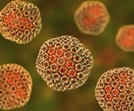 Rift Valley Fever Outbreak in Kenya and Somalia