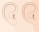 Genetics of Earlobes