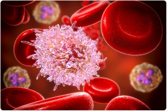 hairy cell leukemia