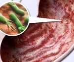 Peptic Ulcer Treatments
