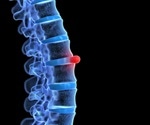 What is Prolapse?