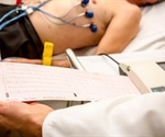 Heart Attack Diagnosis