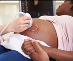 Maternal Health Around the World