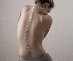 What is Scoliosis?