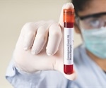 Asymptomatic SARS-CoV-2 individuals with blood group AB at highest risk