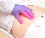 What is Peritonitis?