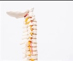 Spina Bifida Symptoms