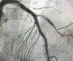 Restenosis Physiology