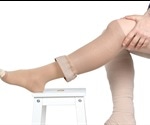 Lymphedema Complications