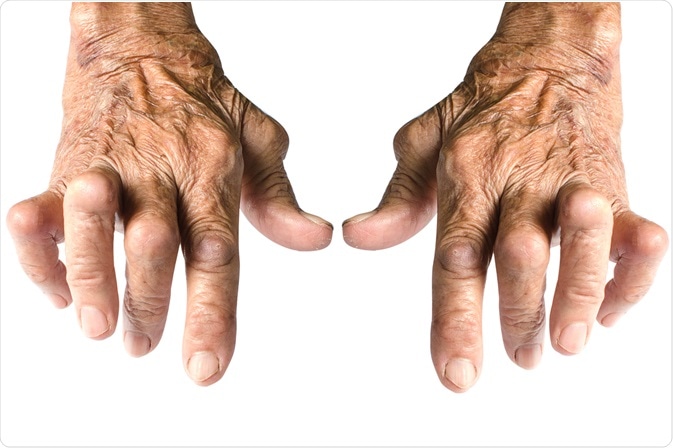 Image Credit: Chaowalit Seeneha / Shutterstock