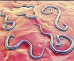 Preventing Toxocariasis