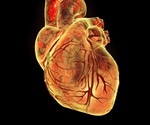 Myocarditis Therapy