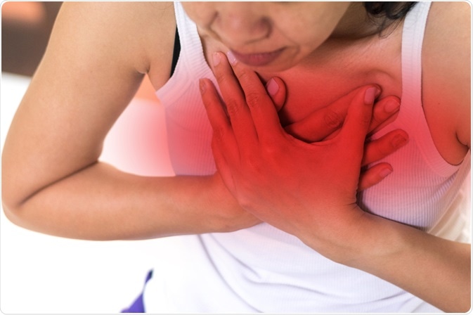 pericarditis