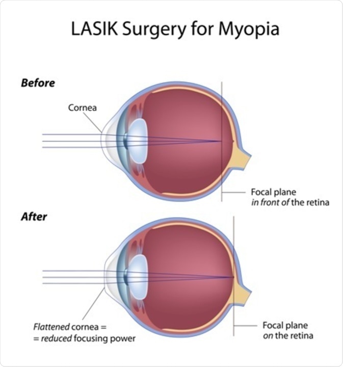 Image Credit: Alila Medical Media / Shutterstock