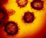 Study shows a protective association between anticoagulants and COVID-19