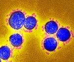 When COVID-19 is severe, rogue antibodies attack body tissues and organs