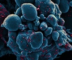 What happens in the first few days of SARS-CoV-2 infection?