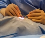 Alzheimer’s patients are less likely to have cataract surgery than those without the condition