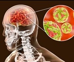 What is Japanese Encephalitis?