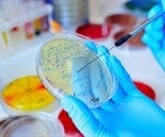 History of Microbiology – Germ Theory and Immunity