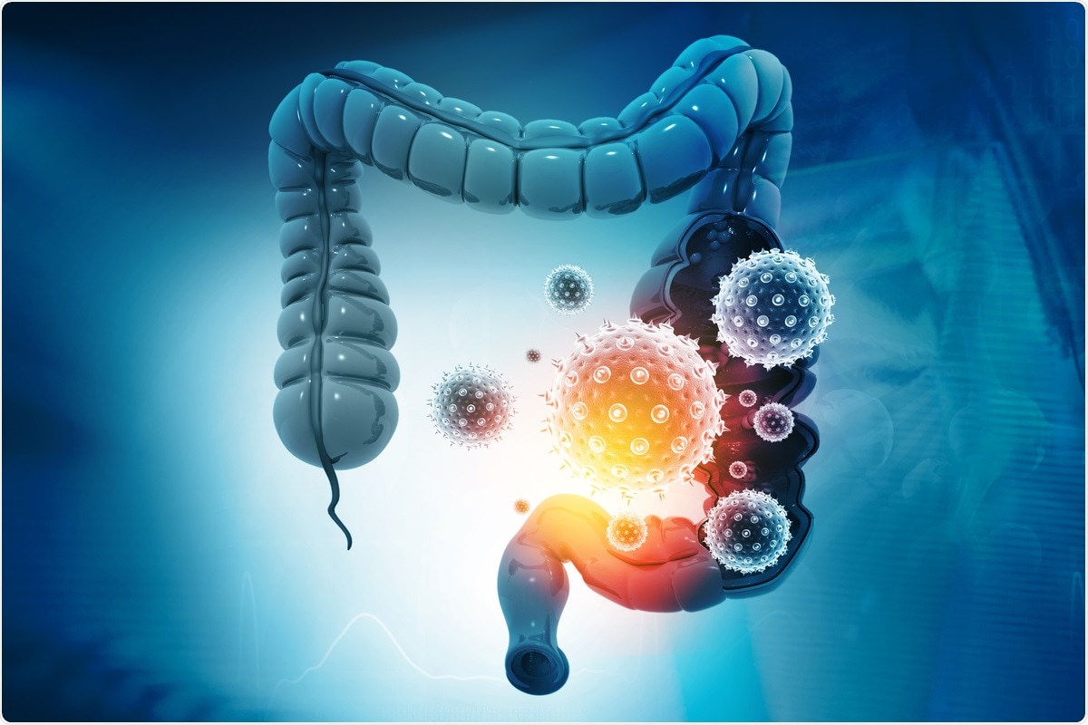 Study: Multisystem inflammatory syndrome in children is driven by zonulin-dependent loss of gut mucosal barrier. Image Credit: Explode / Shutterstock