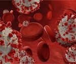 Can SARS-CoV-2’s impairment of endothelium cause vascular disease?
