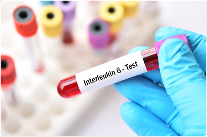 interleukin 6
