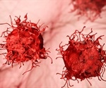 What is a Neoplasm?