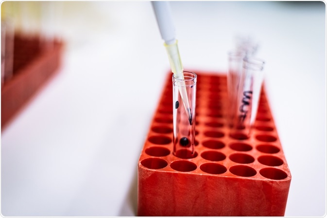 flow cytometry