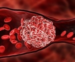 Warfarin Uses