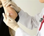 Psoriasis Drug Development