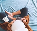 The effects of SARS-CoV-2 vaccination on pregnancy and birth