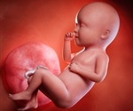 What is Amniotic Fluid?